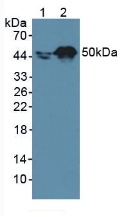 RARA / RAR Alpha Antibody - Western Blot; Sample: Lane1: Human A431 Cells; Lane2: Human HepG2 Cells.