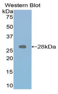 RARA / RAR Alpha Antibody - Western blot of recombinant RARA / RAR Alpha.  This image was taken for the unconjugated form of this product. Other forms have not been tested.