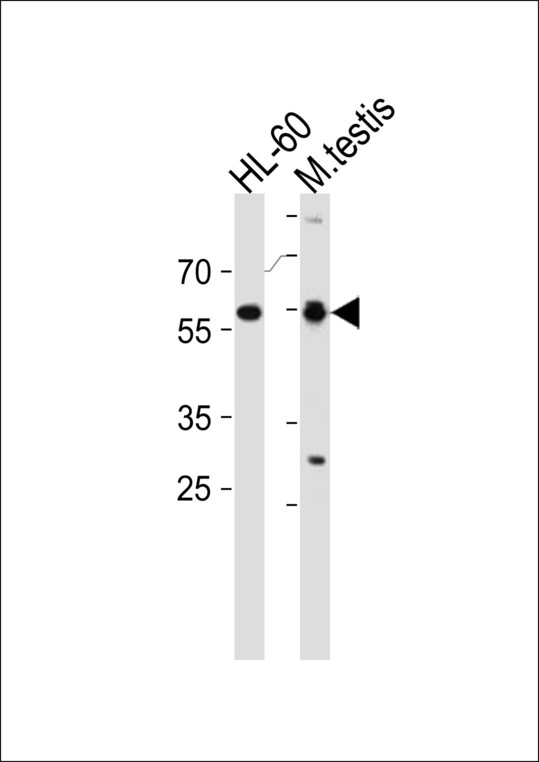 RARA / RAR Alpha Antibody - RARA Antibody western blot of HL-60 cell line and mouse testis tissue lysates (35 ug/lane). The RARA antibody detected the RARA protein (arrow).