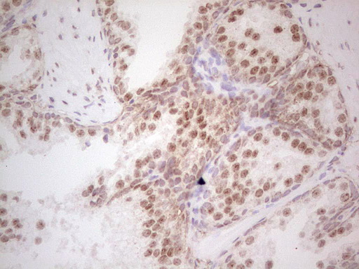 RARA / RAR Alpha Antibody - IHC of paraffin-embedded Human prostate tissue using anti-RARA mouse monoclonal antibody. (Heat-induced epitope retrieval by 1 mM EDTA in 10mM Tris, pH8.5, 120°C for 3min).