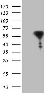 RARA / RAR Alpha Antibody - HEK293T cells were transfected with the pCMV6-ENTRY control (Left lane) or pCMV6-ENTRY RARA (Right lane) cDNA for 48 hrs and lysed. Equivalent amounts of cell lysates (5 ug per lane) were separated by SDS-PAGE and immunoblotted with anti-RARA.