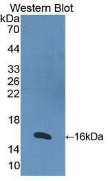 RARA / RAR Alpha Antibody - Western blot of RARA / RAR Alpha antibody.