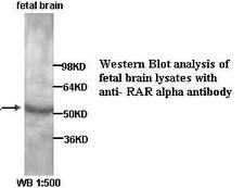 RARA / RAR Alpha Antibody