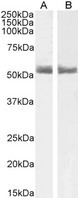 RARA / RAR Alpha Antibody - Goat Anti-RARA Antibody (1µg/ml) staining of Human Breast (A) and Breast cancer (B) lysate (35µg protein in RIPA buffer). Primary incubation was 1 hour. Detected by chemiluminescencence.