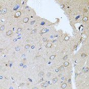RARA / RAR Alpha Antibody - Immunohistochemistry of paraffin-embedded rat brain using RARA antibodyat dilution of 1:100 (40x lens).