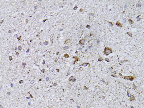 RARA / RAR Alpha Antibody - Immunohistochemistry of paraffin-embedded rat brain using RARA antibodyat dilution of 1:100 (40x lens).