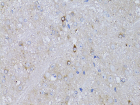 RARA / RAR Alpha Antibody - Immunohistochemistry of paraffin-embedded mouse brain using RARA antibodyat dilution of 1:100 (40x lens).