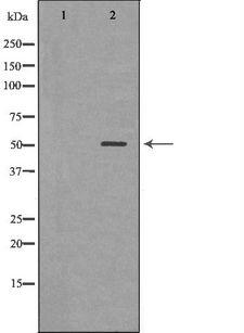 RARA / RAR Alpha Antibody - Western blot analysis of mouse liver tissue lysates using RARA antibody. The lane on the left is treated with the antigen-specific peptide.