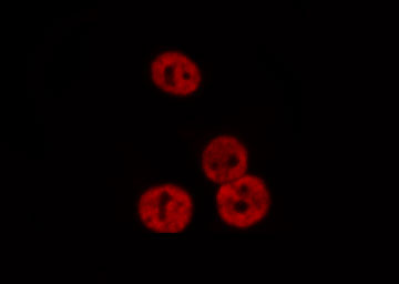 RARA / RAR Alpha Antibody - Staining HeLa cells by IF/ICC. The samples were fixed with PFA and permeabilized in 0.1% Triton X-100, then blocked in 10% serum for 45 min at 25°C. The primary antibody was diluted at 1:200 and incubated with the sample for 1 hour at 37°C. An Alexa Fluor 594 conjugated goat anti-rabbit IgG (H+L) antibody, diluted at 1/600, was used as secondary antibody.