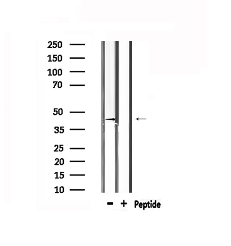 RARA / RAR Alpha Antibody - Western blot analysis of extracts of rat spleen using RARA antibody.