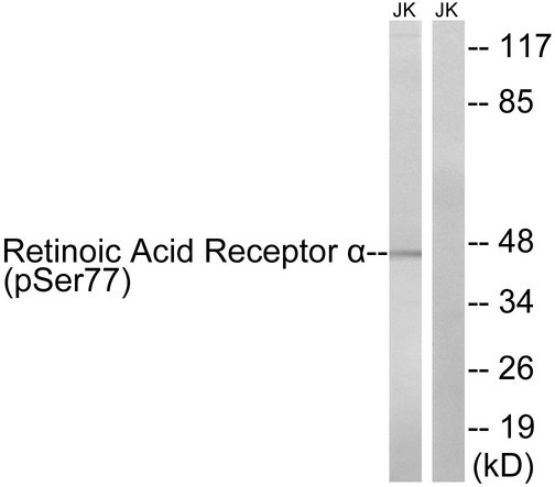 RARA / RAR Alpha Antibody - Western blot analysis of lysates from Jurkat cells treated with PMA 125ng/ml 30' and Jurkat cells treated with insulin 0.01U/ml 15', using Retinoic Acid Receptor alpha (Phospho-Ser77) Antibody. The lane on the right is blocked with the phospho peptide.