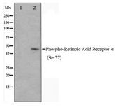 RARA / RAR Alpha Antibody - Western blot of Jurkat cell lysate using Phospho-Retinoic Acid Receptor alpha (Ser77) Antibody
