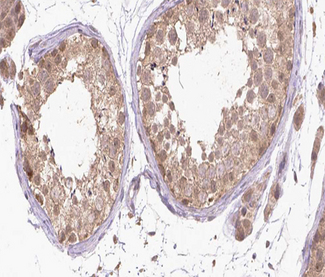 RARA / RAR Alpha Antibody - 1:200 staining human Testis tissue by IHC-P. The tissue was formaldehyde fixed and a heat mediated antigen retrieval step in citrate buffer was performed. The tissue was then blocked and incubated with the antibody for 1.5 hours at 22°C. An HRP conjugated goat anti-rabbit antibody was used as the secondary.