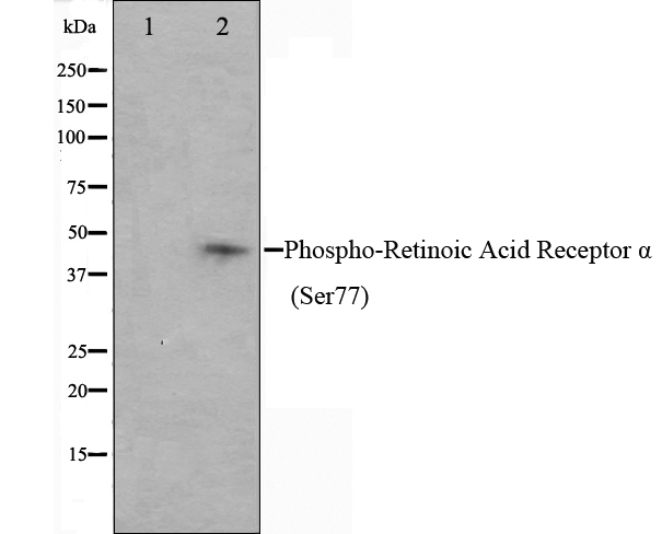 RARA / RAR Alpha Antibody - Western blot analysis on Jurkat cell lysates using Phospho-Retinoic Acid Receptor-alpha (Ser77) antibody. The lane on the left is treated with the antigen-specific peptide.