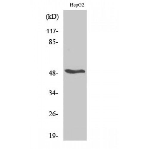RARB / RAR Beta Antibody - Western blot of RAR beta antibody