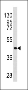 RARB / RAR Beta Antibody - RARB Antibody western blot of 293 cell line lysates (35 ug/lane). The RARB antibody detected the RARB protein (arrow).
