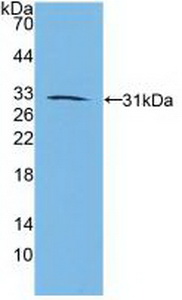 RARB / RAR Beta Antibody - Western Blot; Sample: Recombinant RARb, Human.