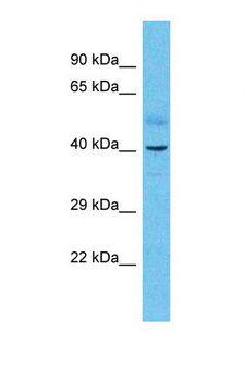 RARB / RAR Beta Antibody - Western blot of Human Uterus Tumor. RARB antibody dilution 1.0 ug/ml.  This image was taken for the unconjugated form of this product. Other forms have not been tested.
