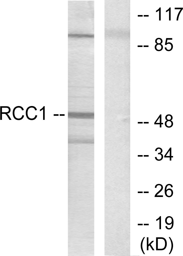 RARB / RAR Beta Antibody - Western blot analysis of lysates from HepG2 cells, using Retinoic Acid Receptor beta Antibody. The lane on the right is blocked with the synthesized peptide.