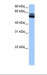 RARB / RAR Beta Antibody - Fetal brain cell lysate. Antibody concentration: 0.5 ug/ml. Gel concentration: 12%.  This image was taken for the unconjugated form of this product. Other forms have not been tested.