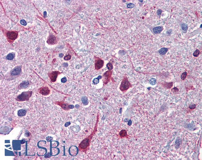 RARB / RAR Beta Antibody - Anti-RARB antibody IHC of human brain, cortex. Immunohistochemistry of formalin-fixed, paraffin-embedded tissue after heat-induced antigen retrieval. Antibody concentration 5 ug/ml.  This image was taken for the unconjugated form of this product. Other forms have not been tested.