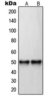 RARB / RAR Beta Antibody - Western blot analysis of RAR beta expression in U87MG (A); MDAMB435 (B) whole cell lysates.