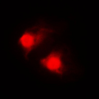 RARB / RAR Beta Antibody - Immunofluorescent analysis of RAR beta staining in MDAMB435 cells. Formalin-fixed cells were permeabilized with 0.1% Triton X-100 in TBS for 5-10 minutes and blocked with 3% BSA-PBS for 30 minutes at room temperature. Cells were probed with the primary antibody in 3% BSA-PBS and incubated overnight at 4 C in a humidified chamber. Cells were washed with PBST and incubated with a DyLight 594-conjugated secondary antibody (red) in PBS at room temperature in the dark. DAPI was used to stain the cell nuclei (blue).