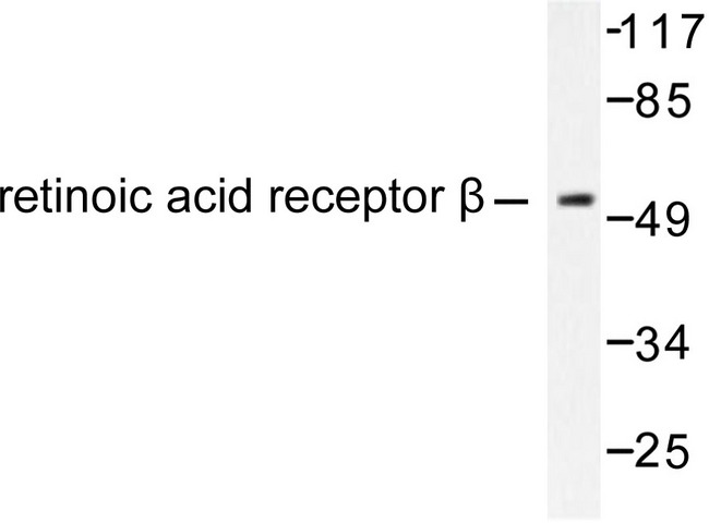 RARB / RAR Beta Antibody - Western blot of Retinoic Acid Receptor (L359) pAb in extracts from HepG2 cells.