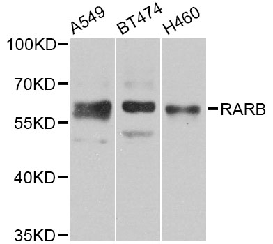 RARB / RAR Beta Antibody - Western blot analysis of extracts of various cell lines, using RARB antibody at 1:1000 dilution. The secondary antibody used was an HRP Goat Anti-Rabbit IgG (H+L) at 1:10000 dilution. Lysates were loaded 25ug per lane and 3% nonfat dry milk in TBST was used for blocking. An ECL Kit was used for detection and the exposure time was 90s.