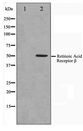 RARB / RAR Beta Antibody - Western blot of HepG2 cell lysate using Retinoic Acid Receptor beta Antibody