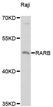 RARB / RAR Beta Antibody - Western blot analysis of extracts of Raji cells, using RARB antibody at 1:3000 dilution. The secondary antibody used was an HRP Goat Anti-Rabbit IgG (H+L) at 1:10000 dilution. Lysates were loaded 25ug per lane and 3% nonfat dry milk in TBST was used for blocking. An ECL Kit was used for detection and the exposure time was 90s.