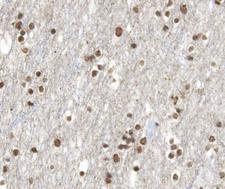 RARB / RAR Beta Antibody - 1:100 staining human brain tissue by IHC-P. The tissue was formaldehyde fixed and a heat mediated antigen retrieval step in citrate buffer was performed. The tissue was then blocked and incubated with the antibody for 1.5 hours at 22°C. An HRP conjugated goat anti-rabbit antibody was used as the secondary.