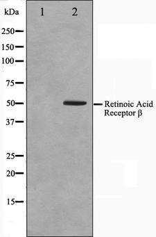 RARB / RAR Beta Antibody - Western blot analysis on HepG2 cell lysates using Retinoic Acid Receptor beta antibody. The lane on the left is treated with the antigen-specific peptide.