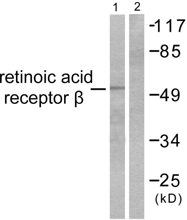 RARB / RAR Beta Antibody - Western blot analysis of extracts from HepG2 cells, using Retinoic Acid Receptor ß antibody.