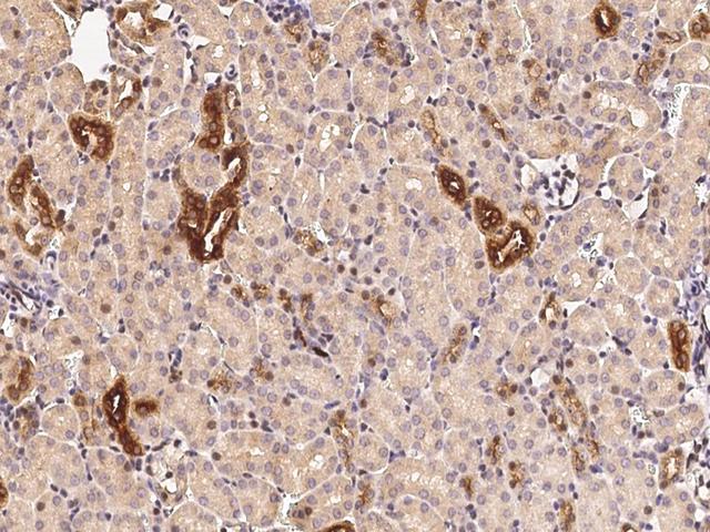 RARB / RAR Beta Antibody - Immunochemical staining RARB in mouse kidney with rabbit polyclonal antibody (1:1000, formalin-fixed paraffin embedded sections).