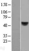 RARB / RAR Beta Protein - Western validation with an anti-DDK antibody * L: Control HEK293 lysate R: Over-expression lysate