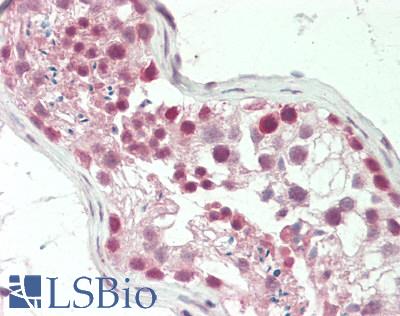 RARG / RAR-Gamma Antibody - Human Testis: Formalin-Fixed, Paraffin-Embedded (FFPE).  This image was taken for the unconjugated form of this product. Other forms have not been tested.