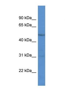 RARG / RAR-Gamma Antibody - RARG antibody Western blot of 3 Cell lysate. Antibody concentration 1 ug/ml. This image was taken for the unconjugated form of this product. Other forms have not been tested.