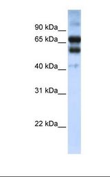 RARG / RAR-Gamma Antibody - Human fetal heart lysate. Antibody concentration: 1.0 ug/ml. Gel concentration: 12%.  This image was taken for the unconjugated form of this product. Other forms have not been tested.