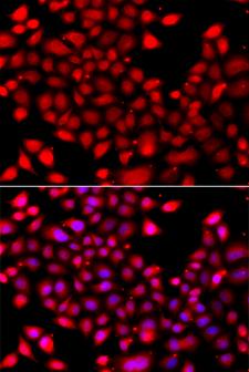 RARG / RAR-Gamma Antibody - Immunofluorescence analysis of A549 cells.
