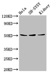 RARG / RAR-Gamma Antibody - Positive Western Blot detected in Hela whole cell lysate, SH-SY5Y whole cell lysate, Mouse kidney tissue. All lanes: RARG antibody at 8 µg/ml Secondary Goat polyclonal to rabbit IgG at 1/50000 dilution. Predicted band size: 51, 50, 43, 48 KDa. Observed band size: 51 KDa