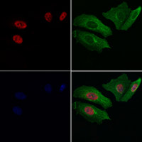 RARG / RAR-Gamma Antibody - Staining HeLa cells by IF/ICC. The samples were fixed with PFA and permeabilized in 0.1% Triton X-100, then blocked in 10% serum for 45 min at 25°C. Samples were then incubated with primary Ab(1:200) and mouse anti-beta tubulin Ab(1:200) for 1 hour at 37°C. An AlexaFluor594 conjugated goat anti-rabbit IgG(H+L) Ab(1:200 Red) and an AlexaFluor488 conjugated goat anti-mouse IgG(H+L) Ab(1:600 Green) were used as the secondary antibod