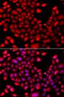 RARG / RAR-Gamma Antibody - Immunofluorescence analysis of A549 cells using RARG Polyclonal Antibody.