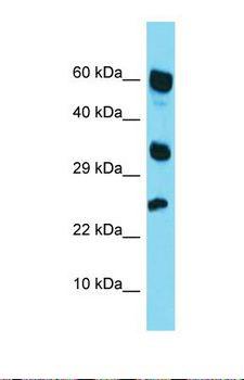 RARRES1 Antibody - Western blot of Human HepG2. RARRES1 antibody dilution 1.0 ug/ml.  This image was taken for the unconjugated form of this product. Other forms have not been tested.