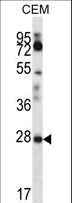 RARRES1 Antibody - RARRES1 Antibody western blot of CEM cell line lysates (35 ug/lane). The RARRES1 antibody detected the RARRES1 protein (arrow).