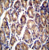RARRES1 Antibody - RARRES1 Antibody immunohistochemistry of formalin-fixed and paraffin-embedded human stomach tissue followed by peroxidase-conjugated secondary antibody and DAB staining.