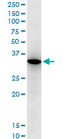 RARRES1 Antibody - RARRES1 monoclonal antibody (M06), clone 2E2. Western blot of RARRES1 expression in HL-60.