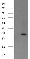 RARRES1 Antibody - HEK293T cells were transfected with the pCMV6-ENTRY control (Left lane) or pCMV6-ENTRY RARRES1 (Right lane) cDNA for 48 hrs and lysed. Equivalent amounts of cell lysates (5 ug per lane) were separated by SDS-PAGE and immunoblotted with anti-RARRES1.