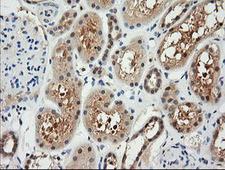 RARRES1 Antibody - IHC of paraffin-embedded Human Kidney tissue using anti-RARRES1 mouse monoclonal antibody.