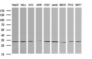 RARRES1 Antibody - Western blot of extracts (35 ug) from 9 different cell lines by using anti-RARRES1 monoclonal antibody (HepG2: human; HeLa: human; SVT2: mouse; A549: human; COS7: monkey; Jurkat: human; MDCK: canine; PC12: rat; MCF7: human).
